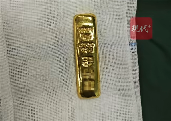 揭秘吞金真相，男孩误吞金条紧急手术取出引发关注